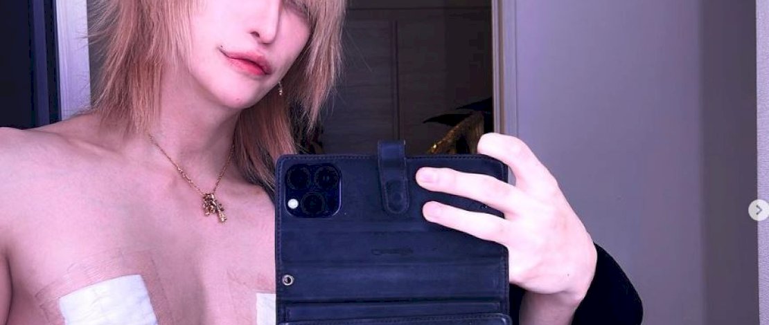  Gitaris rock Jepang, MiA, mengunggah foto dirinya usai melakukan pengangkatan puting