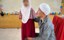 Tak Punya Tangan dan Hanya Miliki Satu Kaki, Bocah Perempuan di Jeneponto Tetap Semangat Bersekolah 