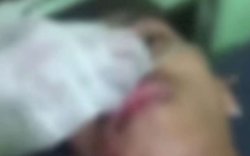 Oknum Perawat Diduga Ledek Pasien Koma di Gowa Sambil Direkam