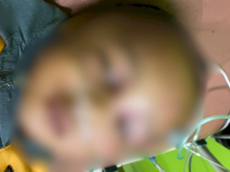 NA, Bocah 3 Tahun di Bone Jadi Korban Penganiayaan Misterius