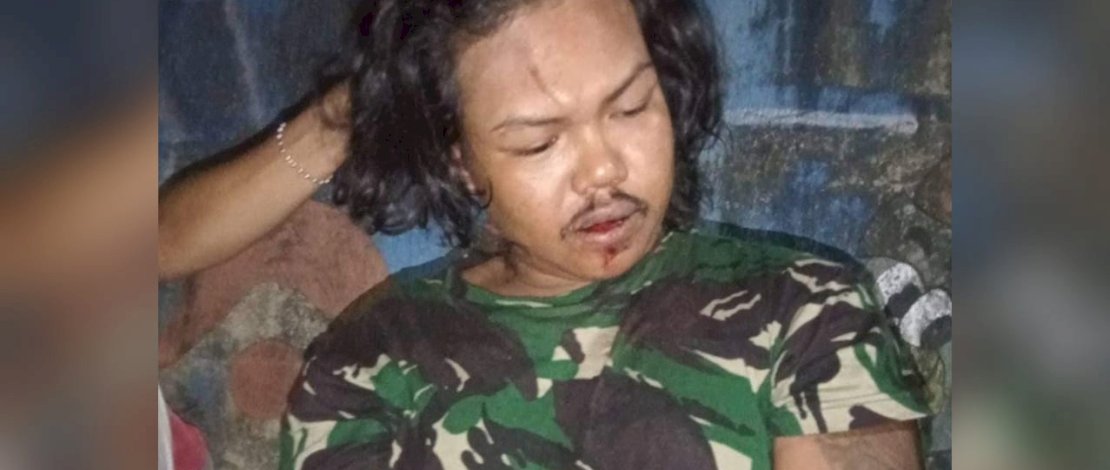 Pelaku pencurian babak belur diamuk warga. Pelaku pencurian babak belur diamuk warga.