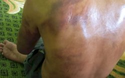 Minta Perlindungan ke Polisi Usai Bertengkar dengan Istri, Pria Ini Malah Dianiaya Kanit Reskrim Polsek Ajangale