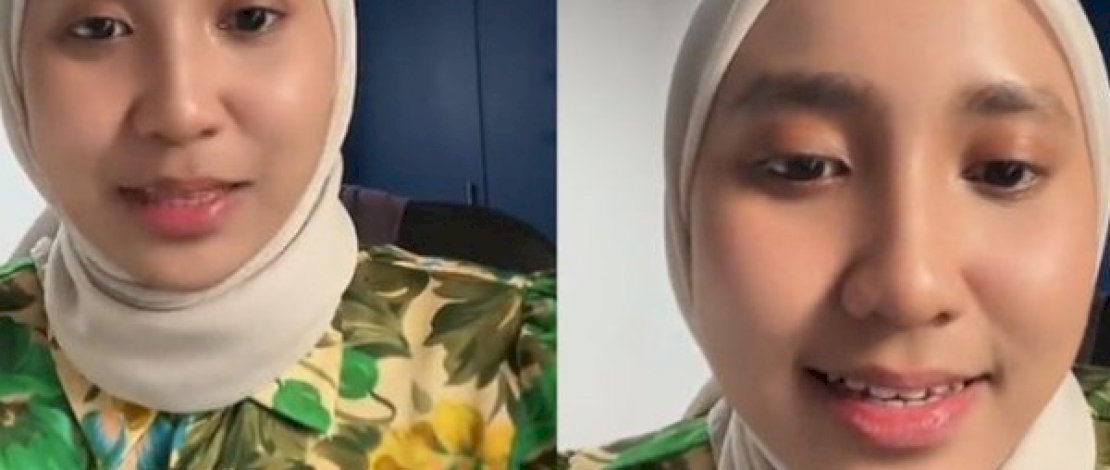 Sering Pakai Lipstik Tester, Wanita di Malaysia Terjangkit Herpes 