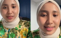 Sering Pakai Lipstik Tester, Wanita di Malaysia Terjangkit Herpes 
