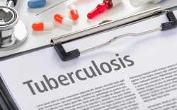 Upaya Eliminasi TB Terus Dilakukan, Saat Ini Tercatat 393 Ribu Kasus