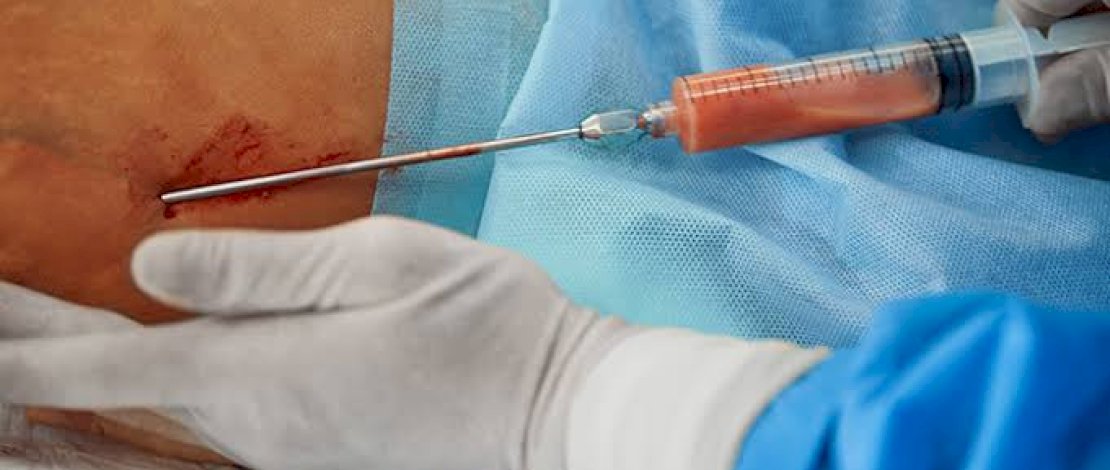 Selebgram Asal Medan Meninggal Usai Sedot Lemak, DPR Minta Izin Klinik Kecantikan Diperketat