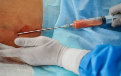 Selebgram Asal Medan Meninggal Usai Sedot Lemak, DPR Minta Izin Klinik Kecantikan Diperketat