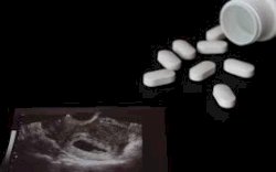 Nekat Aborsi, Sepasang Kekasih di Makassar Terancam Pidana Penjara 5 Tahun