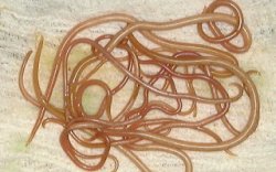 Perut Bocah 3 Tahun di Jember Penuh Cacing, Ini Penjelasan Ahli