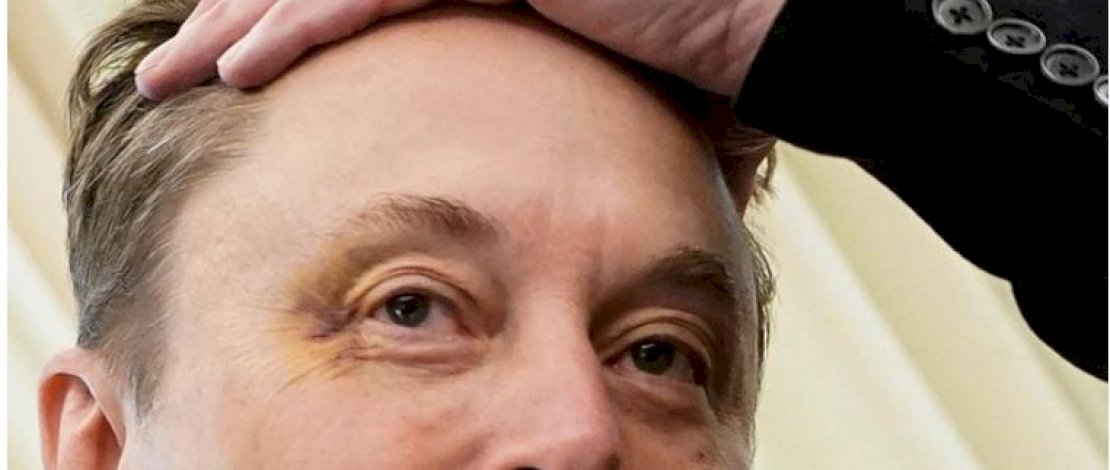Mata Elon Musk Lebam Saat Muncul di Gedung Putih Usai Mundur dari Pemerintahan Trump Ternyata...
