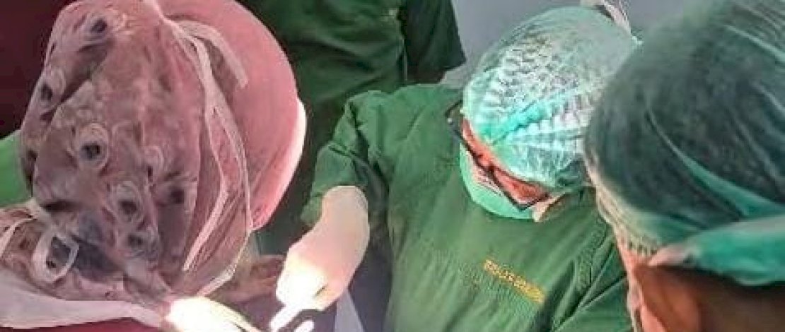 Tim Medis Unhas melakukan tiga operasi caesar darurat terhadap ibu hamil yang membutuhkan penanganan segera di RSUD Pidie Jaya, Rabu malam, 3 Desember 2025.