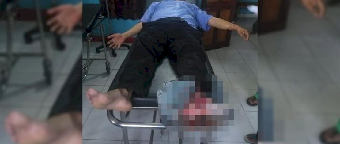 Korban bernama Bambang Purwoko. IST