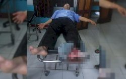 TGPF Intan Jaya Ditembaki KKB di Papua, Dosen UGM dan TNI Terluka