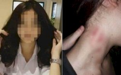 Ada Bekas Cupang, Aksi Gadis Indehoi dengan 5 Pria Diketahui Sang Ibu