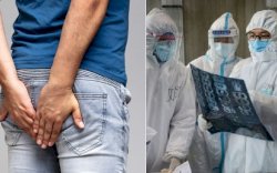 Bisakah Covid-19 Menyebar Melalui Kentut? Begini Penjelasan Para Ahli Medis