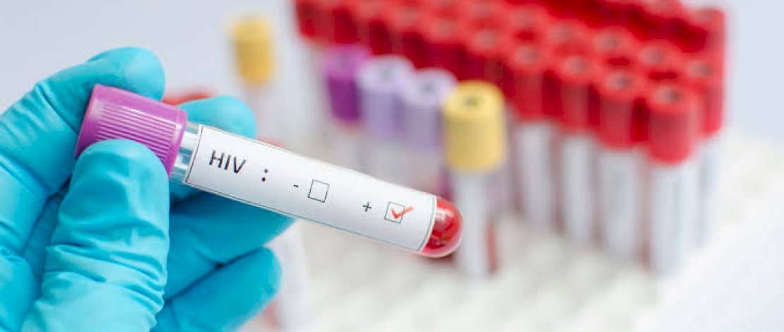 Ilustrasi tes HIV. 