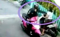 Wajah Wanita Muda Disiram Cairan Diduga Sperma