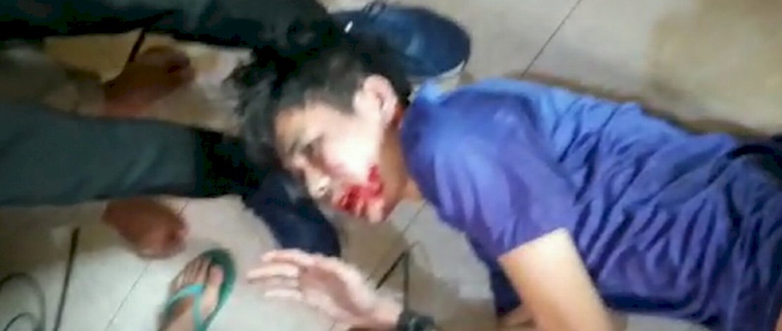 Detik-detik penikaman Syekh Ali Jaber, pelaku saat tertangkap, dan Syekh Ali Jaber saat di rumah sakit.