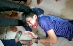 Mahfud MD Perintahkan Terbuka, Pelaku Penusukan Syekh Ali Jaber Ditetapkan Tersangka