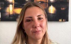 Wanita Ini Dikeroyok 3 Pria karena Pakai Rok Terlalu Pendek 