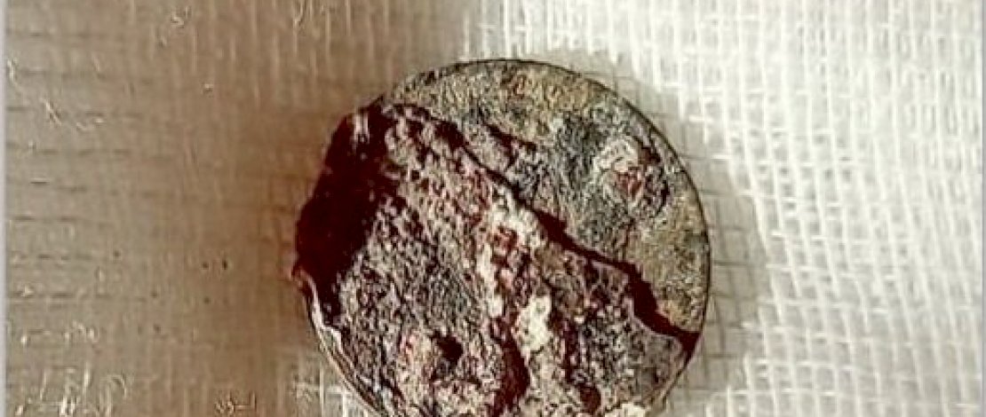 Foto: Konchalovsky City Clinical Hospital

