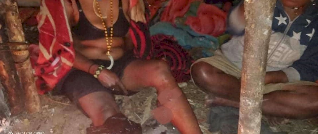 Foto seorang anggota OPM mengalami luka tembak.