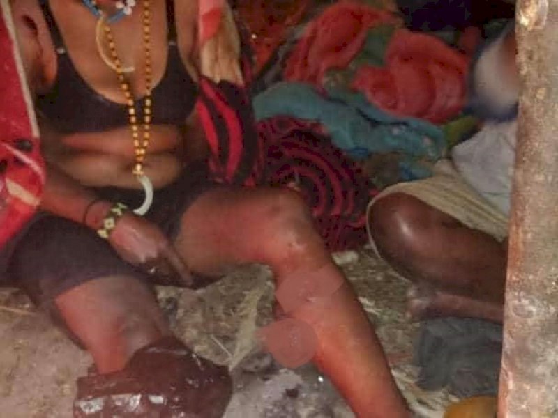 OPM Rilis Foto Dua Anggotanya yang Terluka, Satu Wanita
