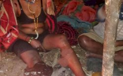 OPM Rilis Foto Dua Anggotanya yang Terluka, Satu Wanita