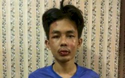 Polisi Abaikan Klaim Gangguan Jiwa Penusuk Syekh Ali Jaber