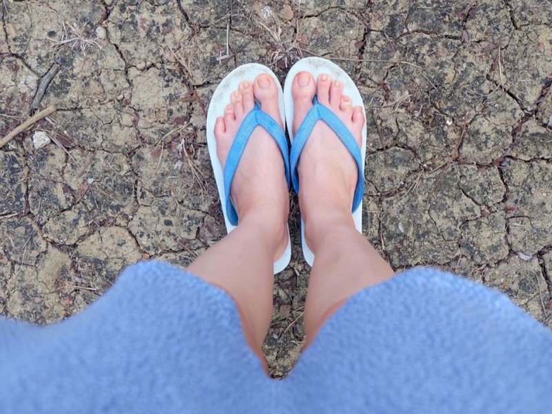 Sering Pakai Sandal Jepit Ternyata Bisa Ganggu Kesehatan